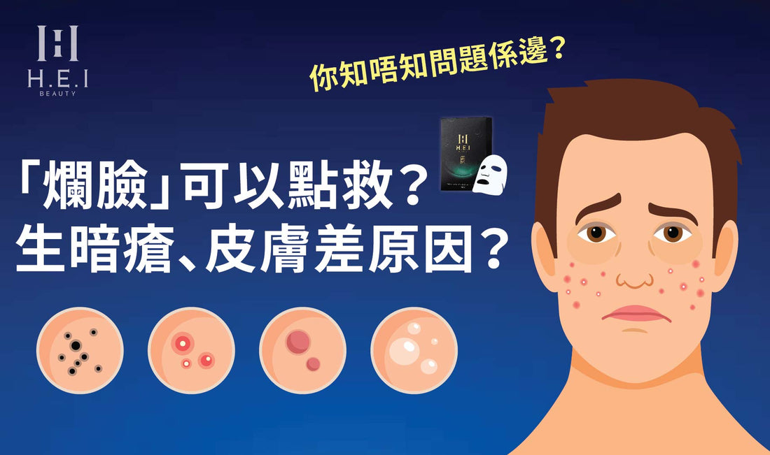 「爛臉」可以點救？｜生暗瘡、皮膚差原因？拆解成因及應對方法